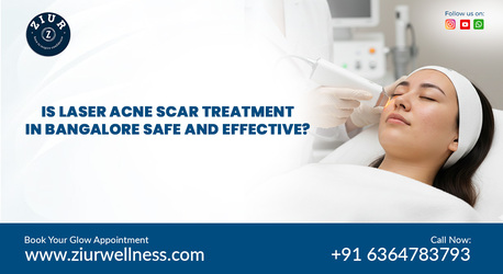 Best Acne Scar Treatment Near Me In Bangalore photo 1