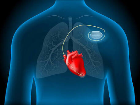 Cardiac Battery Programming And Testing In Abu Dhabi | Bone Care One Day Surgery Center photo 1