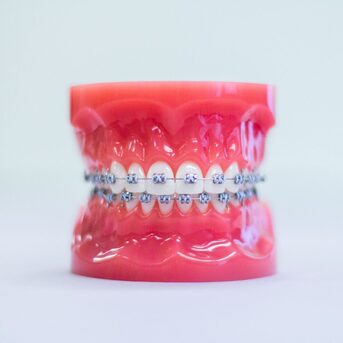 TMJ Disorder Treatment By Top Orthodontist Specialist In Dubai! photo 1