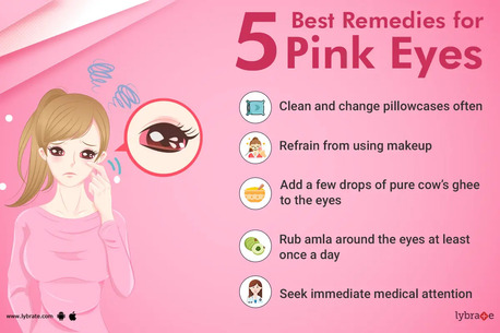 Natural Remedies For Pink Eye: Gentle Home Relief Options photo 1