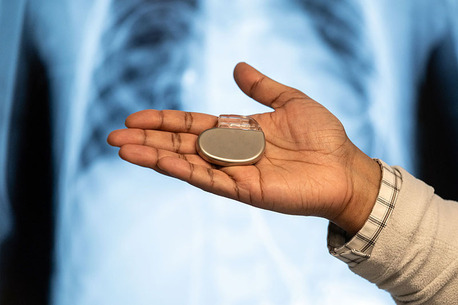 Advanced Pacemaker Treatment At TheHeart.ae In UAE photo 1