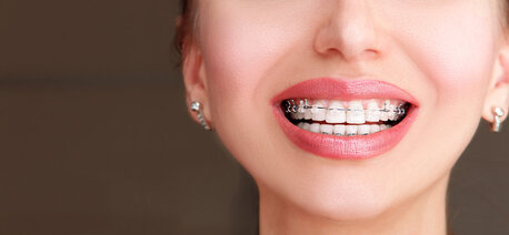 TMJ Disorder Treatment By Top Orthodontist Specialist In Dubai! photo 2